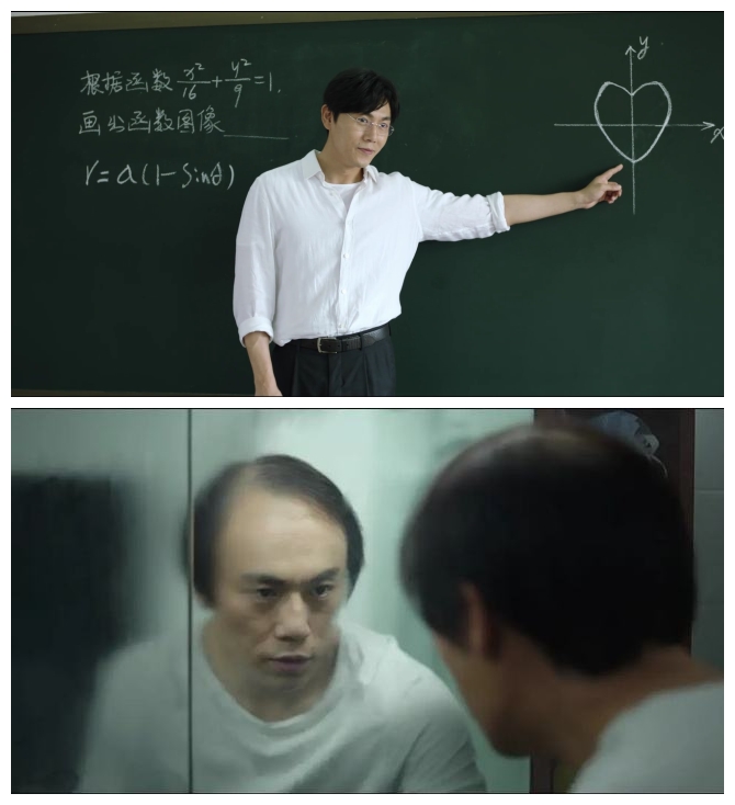 发际线保卫战如何打赢,发际线保卫战完整版