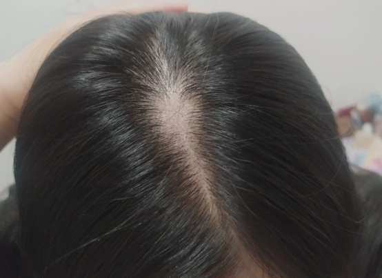 洗发水真的是智商税吗,孕妇专用洗发水是骗人的吗