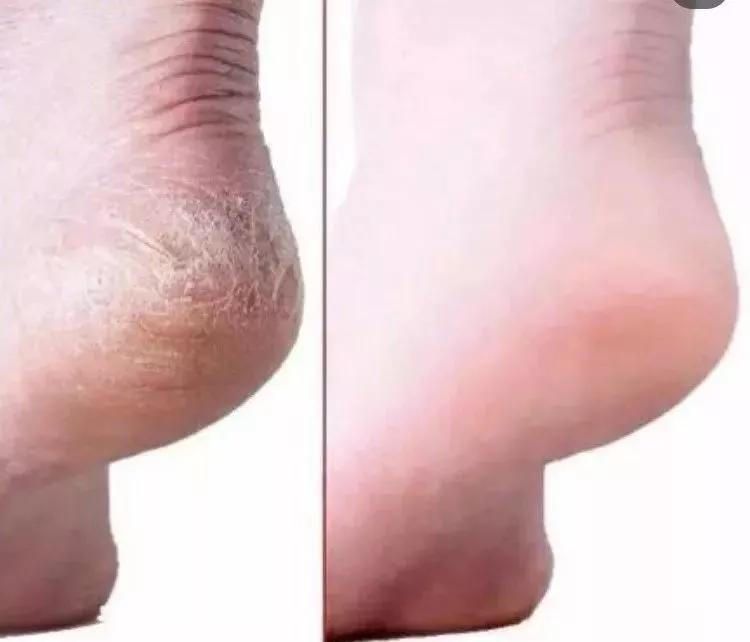 祛除角质细纹的护手霜,干裂护手霜秋冬季