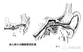 5岁孩子感冒后鼻子里面发红肿大,小孩子发烧后耳朵后面长大包