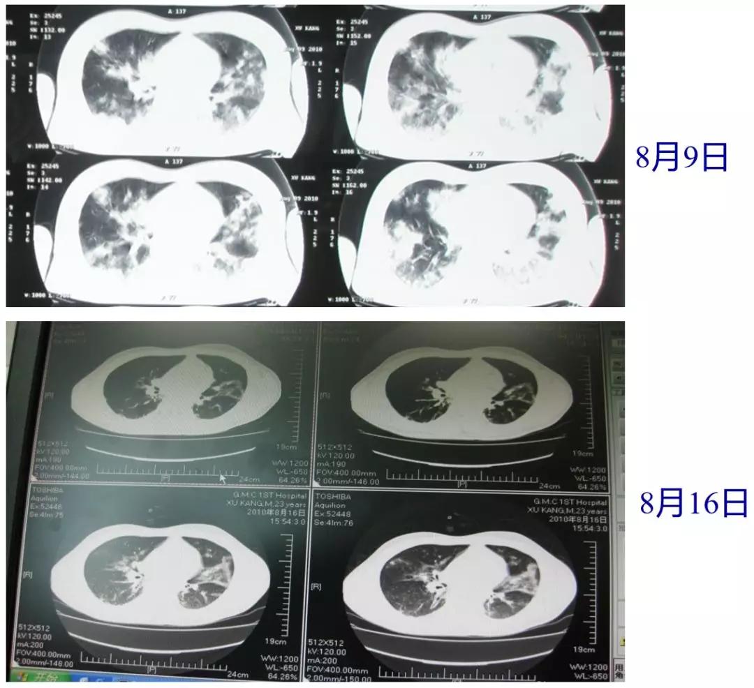 陈荣昌在哪个医院,陈荣昌广州呼吸疾病研究所所长