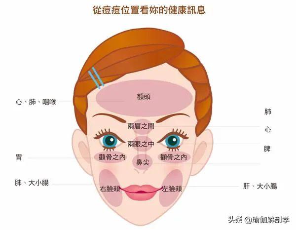 脸上长痘是脾胃出了问题,脸上老是长痘是身体哪里出问题了