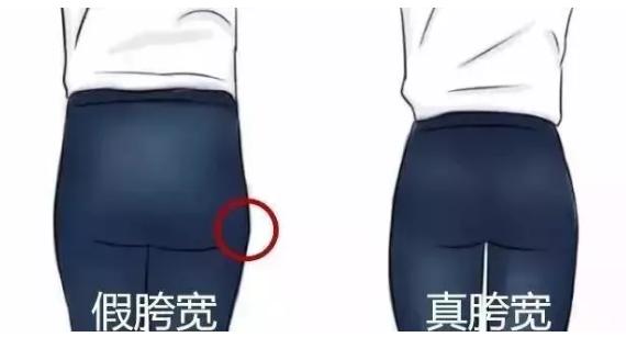 假胯宽真的能挽救吗,假胯宽大腿粗怎么办