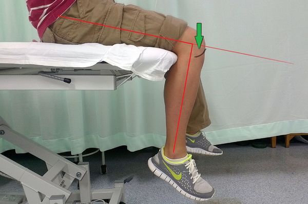 膝盖滑膜炎遇冷就痛,膝盖滑膜炎疼最快缓解方法小妙招