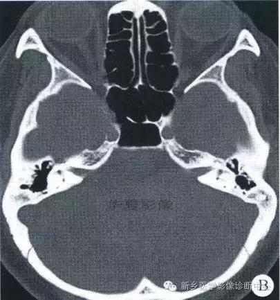 这些部位的黑色素瘤，您会诊断吗？