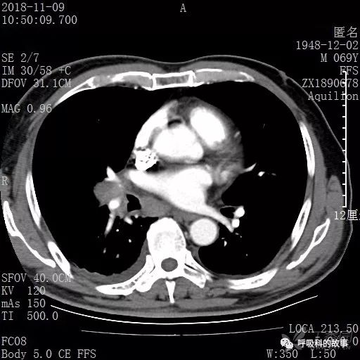 怎么应用统计学做调查,统计学方法可以解决的主要问题