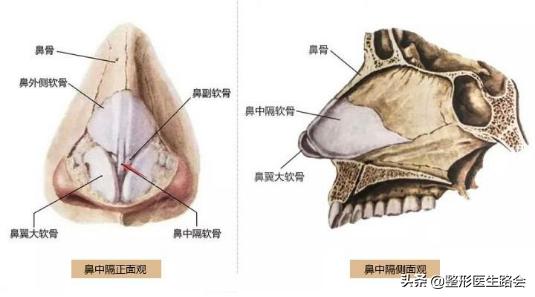 鼻中隔软骨隆鼻失败怎么修复,鼻中隔软骨隆鼻应注意什么