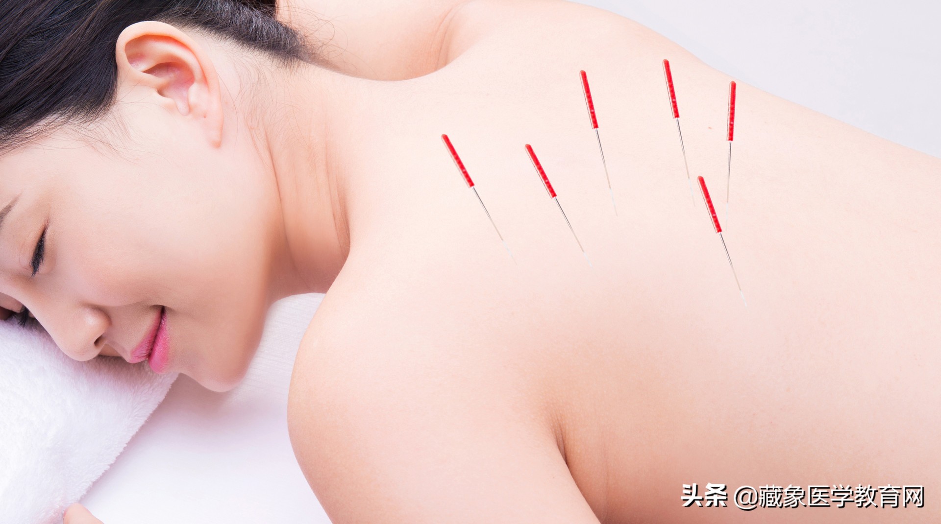 海外针灸,中医针灸真的那么神奇吗