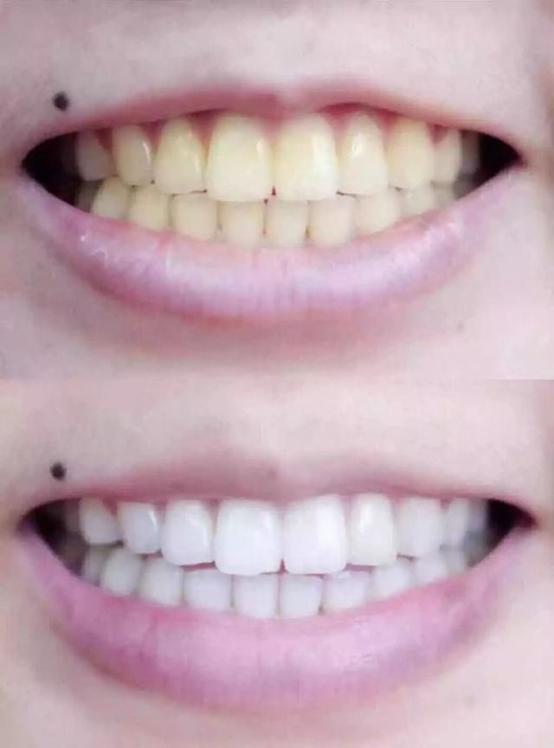 杨颖和姚晨演技,姚晨和杨颖谁的嘴巴大