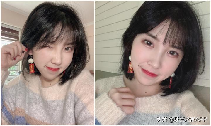 不靠整容怎么改变下巴后缩？看这里