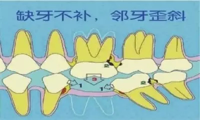 牙可以刷的干干净净的小秘诀,牙到底怎么刷才能刷得干净