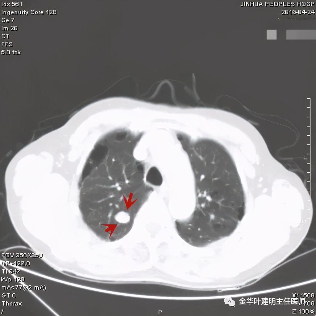 误诊报告图片,误诊案例及案例分析