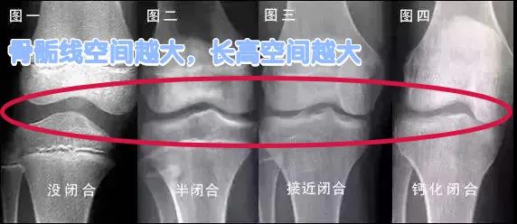 女生17岁155cm还能长多高,女孩身高155不能报考什么专业