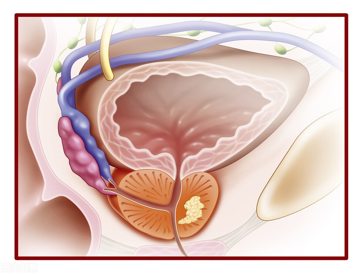 慢性前列腺炎正确用药方法,慢性前列腺炎对男性的影响