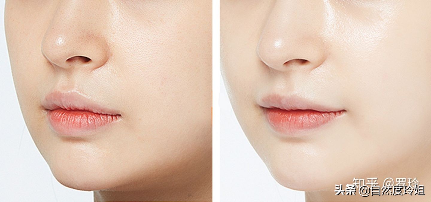 如何快速改善素颜皮肤,怎么做到皮肤又白又发光素颜