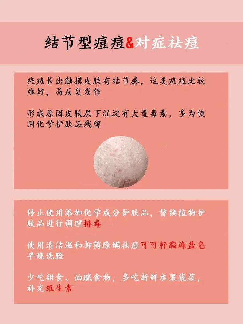 可以针清的痘痘类型,怎么区分各种类型的痘痘