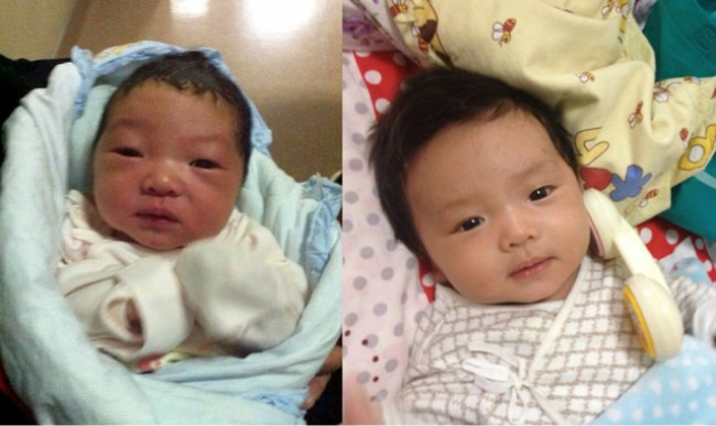 新生儿前后对比照,孩子小时候丑别急着扔掉