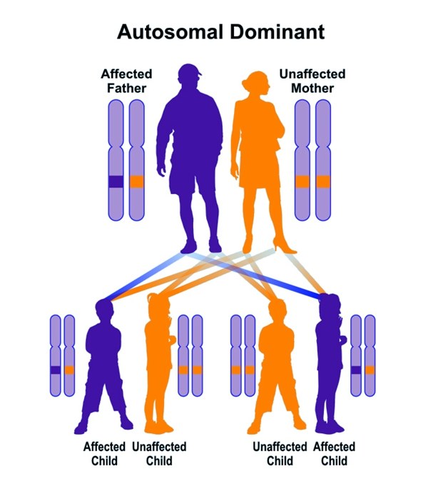 全身肿瘤怎么治疗,浑身长满肿瘤怎么办
