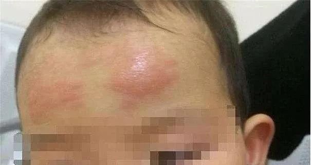 退烧贴骗父母吗,退热贴骗人案例