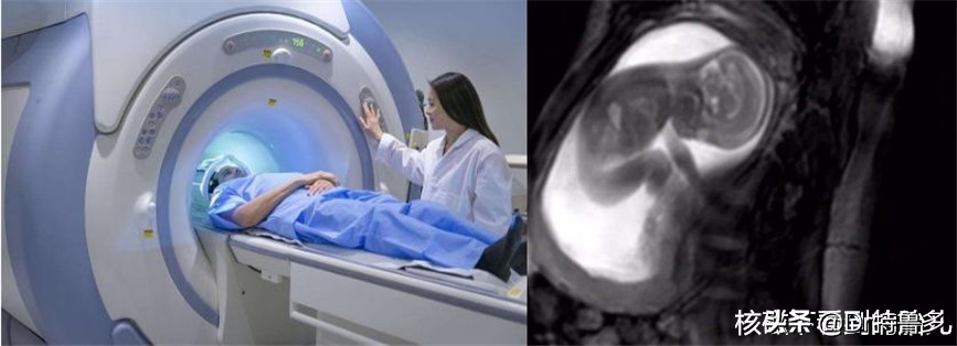 怀孕初期照了x光有影响吗,照了手部x光当月怀孕了有影响吗