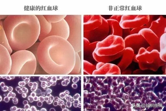 超氧自体血回输疗法是治什么病的,三氧自体血回输疗法简介