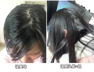 油头救星澳洲茶树洗发水,茶树精油酸性顺滑洗发水