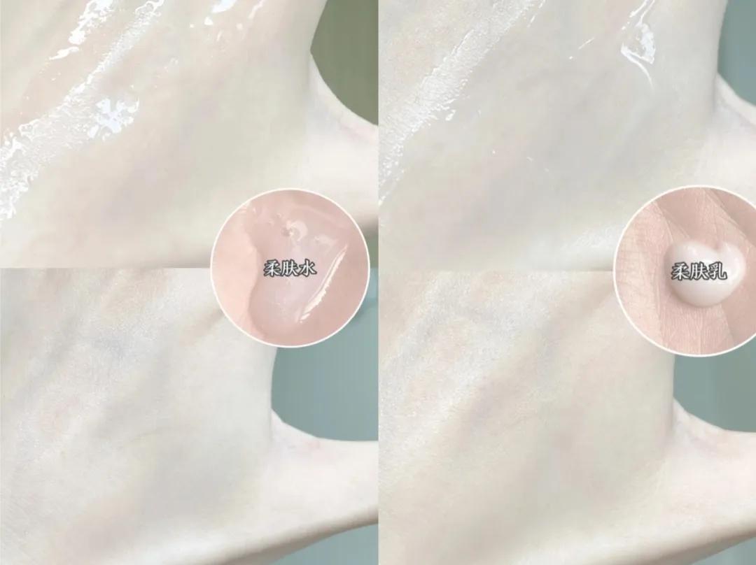 推荐水乳油皮痘肌秋冬季,混油皮夏季水乳