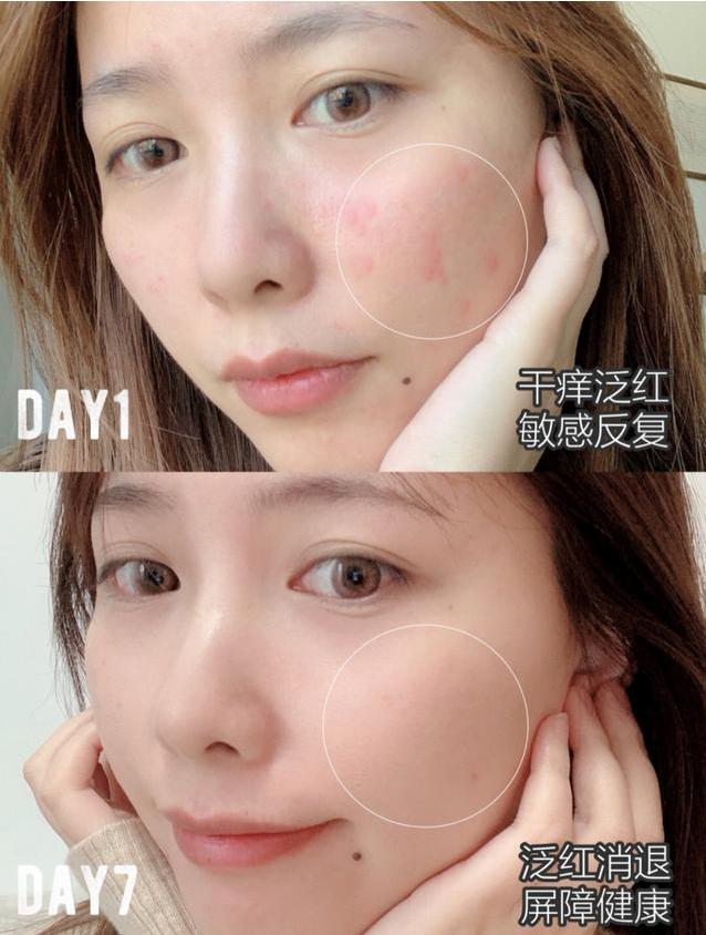 长期去美容院的女人，坚持10年会有哪些变化？网友：不敢信