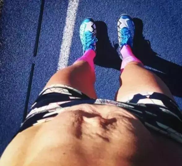 产后肚皮松像口袋一样,产后肚子松垮是腹直肌分离吗