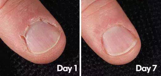 片仔癀28岁干皮适合哪一套护肤,片仔癀脸部护理