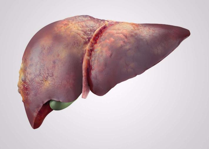早期体内有癌怎么查才知道,身体里有癌手脚先告诉你什么症状