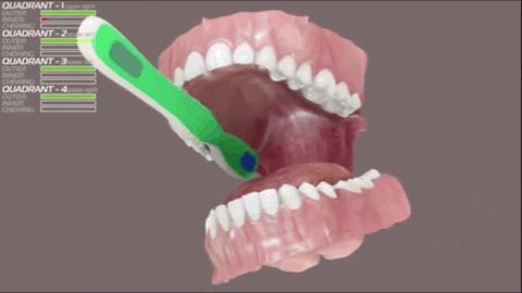 真实有效的美牙产品平价,网友圈疯传的美牙神器