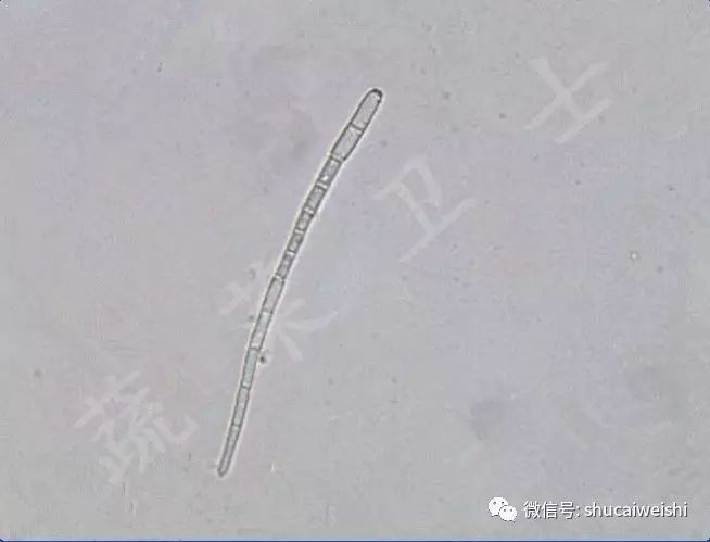 辣椒叶长黄锈斑,辣椒叶上长的黄斑怎么治