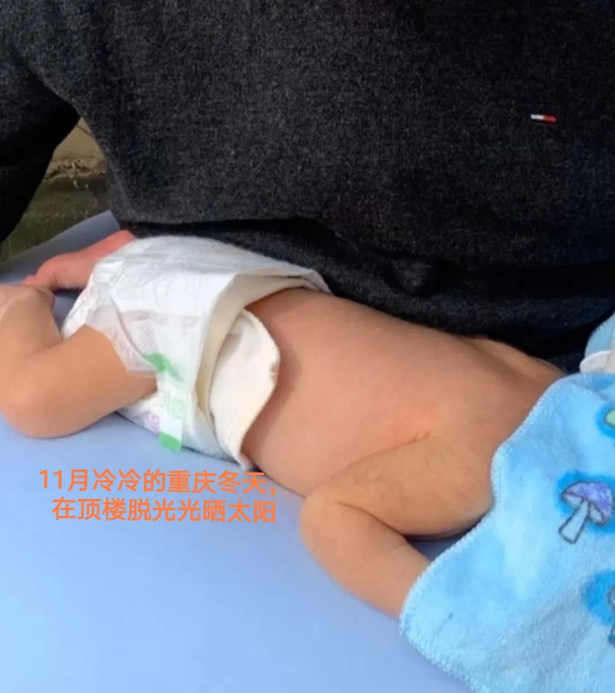 宝宝黄疸好转有哪些征兆,亲身经历宝宝黄疸过程