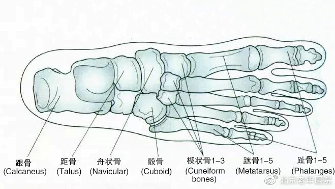 【为了您的健康，我们的专家有话说】足跟痛的黑锅不能全让骨刺来背，揪出幕后的真正元凶