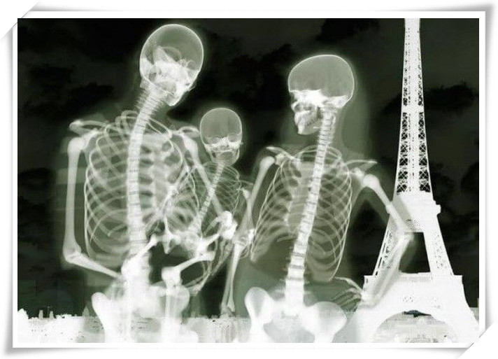 握手、亲吻、喝水、高跟鞋！X射线下人体的样子是啥样？