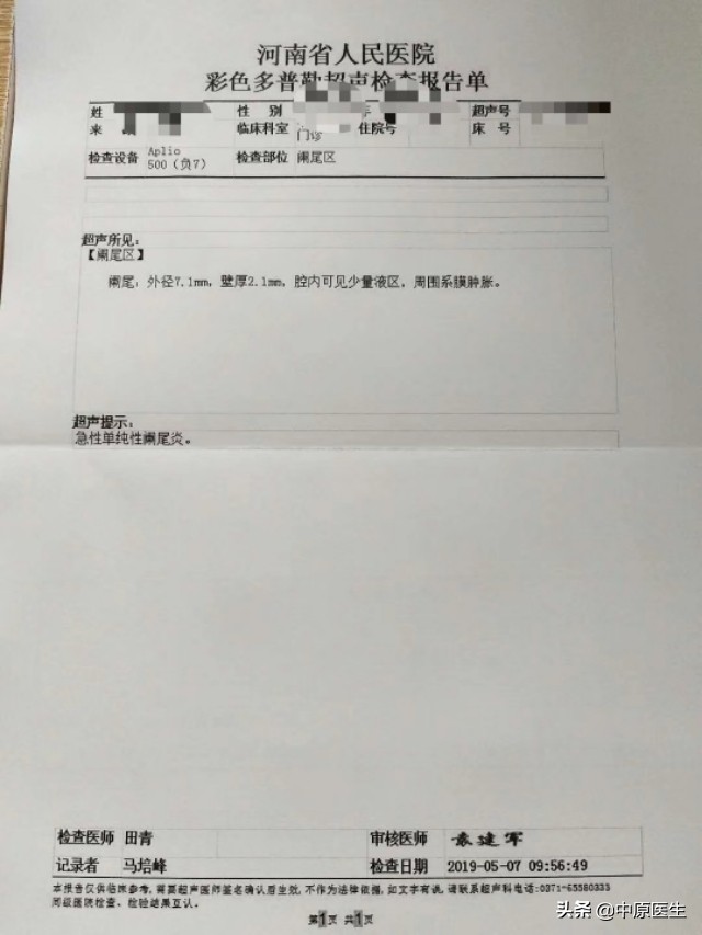 一个切口的阑尾炎手术,阑尾炎微创肚脐部位有个洞