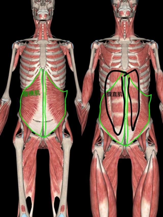 老师:孩子都大了,腹部还松弛下垂像刚出月子,有办法恢复吗?有
