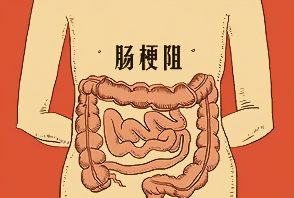 大肠癌切除后腹胀,大肠癌腹痛是牵扯疼吗