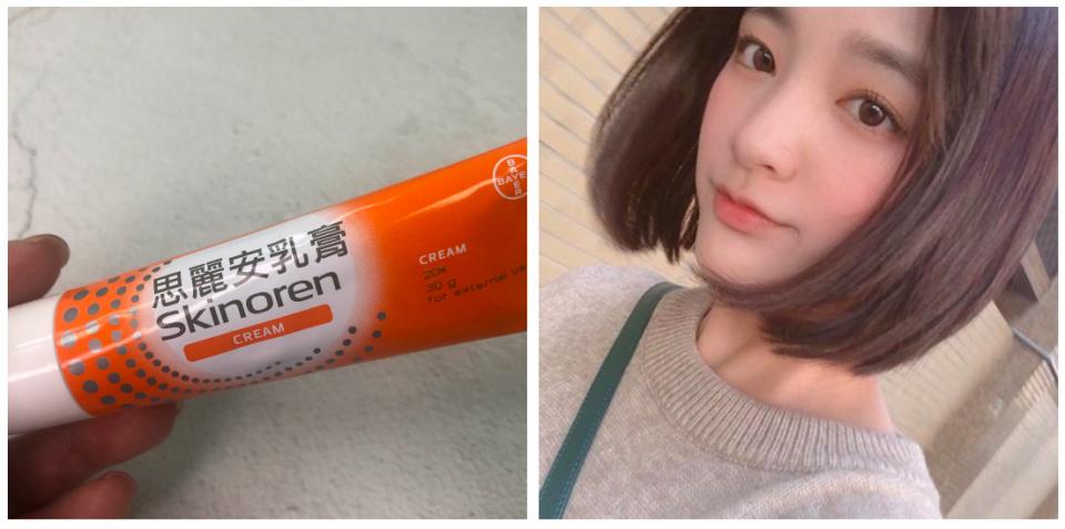 明星推荐的草本祛痘膏,女明星用的药膏