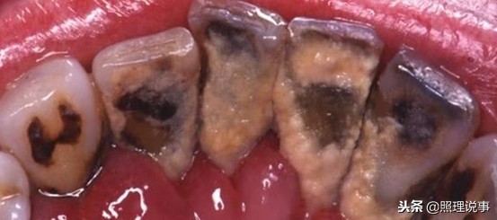 韩国的烟民真不容易！每天面对这样的恶心图片，还下得去嘴吗？