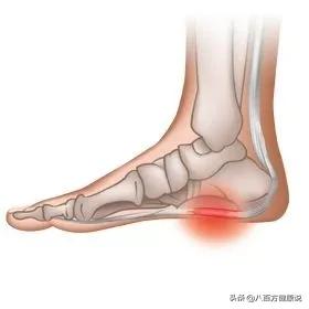 10岁小孩脚后跟痛原因及治疗方法,脚后跟疼的偏方小妙招