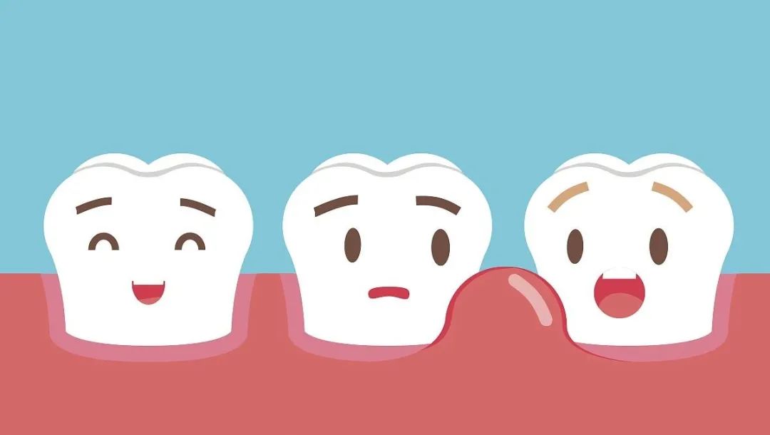 两面针护龈防出血,牙龈肿痛出血有何偏方