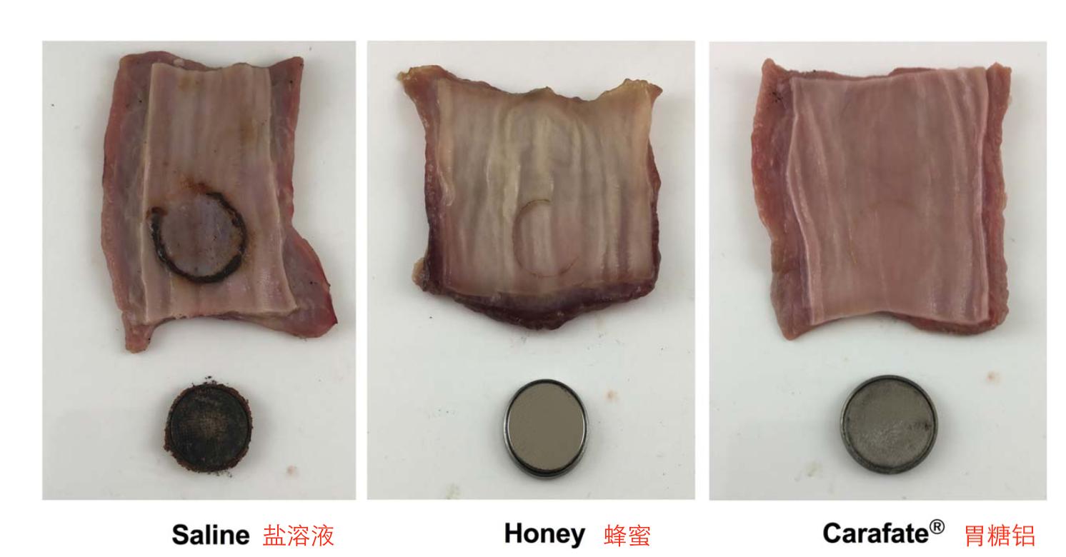 小孩误吞纽扣电池是什么症状,孩子误吞了纽扣电池