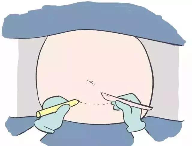 世上最丑的“微笑”，你也曾拥有过？ta令人痛苦、自卑，但伟大！