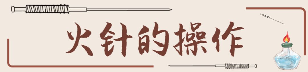 中医火针疗法教学视频,火针操作手法