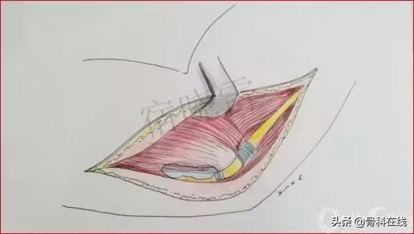 手绘科普类,手绘类科普