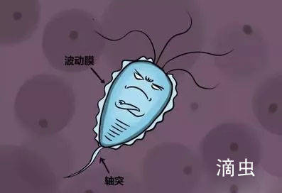 阴道炎常见原因检查标准