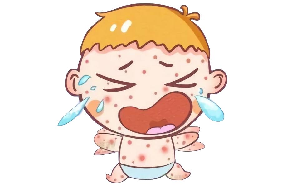 压力紫癜和过敏紫癜如何区分,肠胃性过敏紫癜是腹型过敏紫癜吗