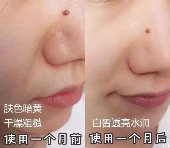 虾青素推荐新西兰,平价虾青素抗老精华